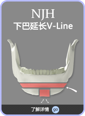 턱끝연장V라인